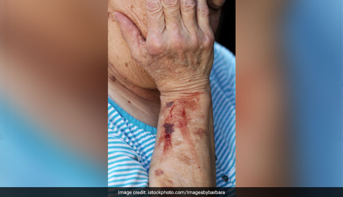 1 in 5 Eldery In India Abused: WHO