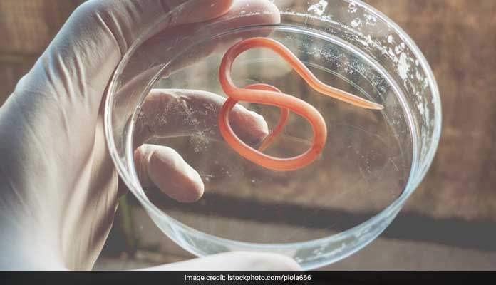 A Worm Removed From A Womans Eye in Kerala