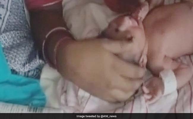 Rats Nibble On Newborn Baby's Fingers In A Rajasthan Hospital