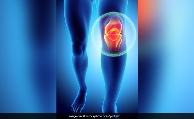 Women Are More Prone to Osteoarthritis Than Men, Says Study