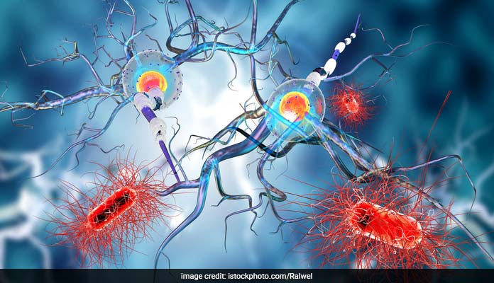 Parkinson's May Begin In Gut Cells: Study