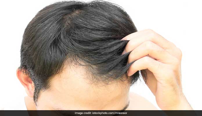 Hair Care: आपके बाल पतले हो रहे हैं या झड़ रहे हैं कैसे करें पहचान? डॉक्टर ने सुझाए आसान तरीके, जानिए