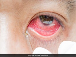 Eye Swelling Remedies: अक्सर सूजी हुई पलकें और लाल आंखें बिगाड़ देती हैं सूरत, इन घरेलू नुस्खों को आजमाएं और पाएं तुरंत आराम Eye Swelling Remedies: अक्सर सूजी हुई पलकें और लाल आंखें बिगाड़ देती हैं सूरत, इन घरेलू नुस्खों को आजमाएं और पाएं तुरंत आराम