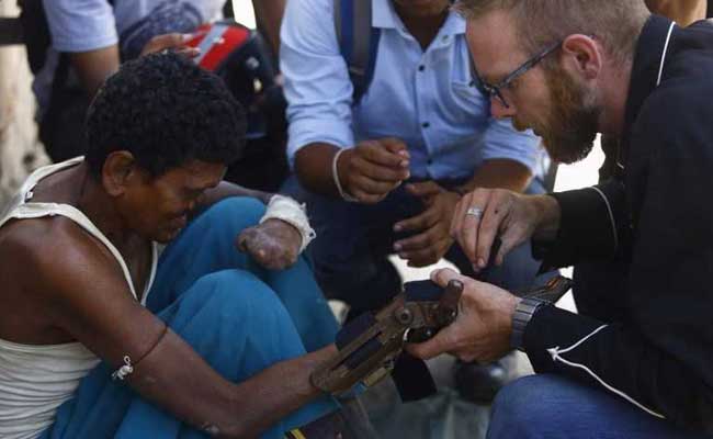 Cheap 3D Printed Prosthetics Could Be Game Changer For Nepal