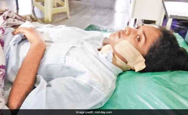 Mumbai Boss Calls Teen To Mall To Pay Salary, Slashes Her Face