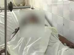 Fourth Acid Attack On Uttar Pradesh Gang-Rape Survivor. She Had Full-Time Security