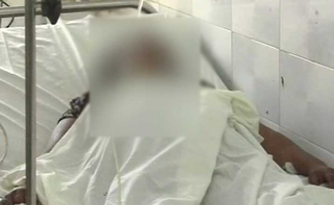 Fourth Acid Attack On Uttar Pradesh Gang-Rape Survivor. She Had Full-Time Security