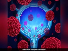 Symptoms Of Prostate Cancer: पुरुषों इन 9 शारीरिक बदलाओं को न करें इग्नोर, दिखने पर तुरंत लें एक्शन Symptoms Of Prostate Cancer: पुरुषों इन 9 शारीरिक बदलाओं को न करें इग्नोर, दिखने पर तुरंत लें एक्शन