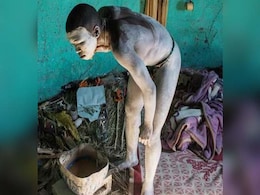 South Africa Circumcision Ritual, A Dangerous Route To Manhood South Africa Circumcision Ritual, A Dangerous Route To Manhood