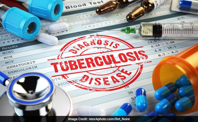 NGO Says 18 Mumbaikars Die Of Tuberclosis Every-day