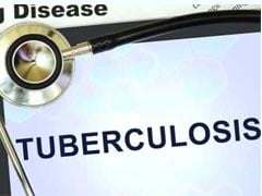 Tuberculosis Treatment: 8 Foods That Can Help You Recover Faster