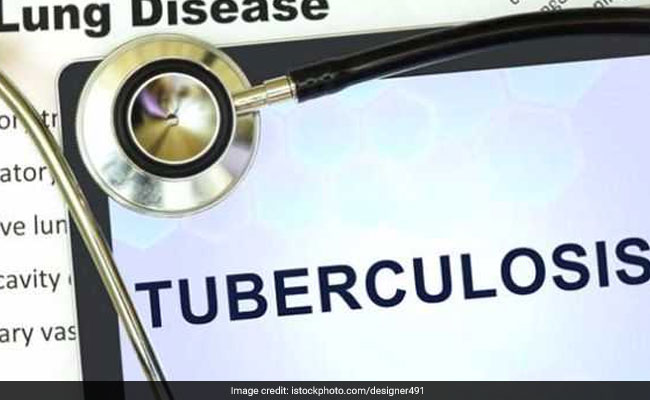 Tuberculosis Diet Chart