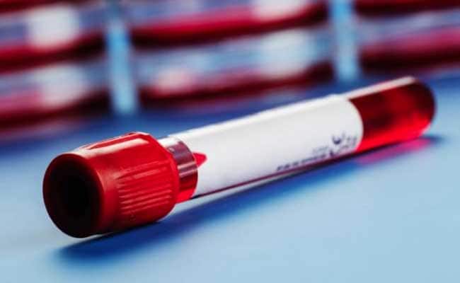 Blood cancer can cause common symptoms that need to be medically evaluated