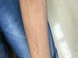 No Evidence Of Any Death Due To Blue Whale Challenge Game:Government No Evidence Of Any Death Due To Blue Whale Challenge Game:Government