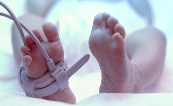 My Baby Girls Are In Intensive Care. What Parents Here Go Through Everyday