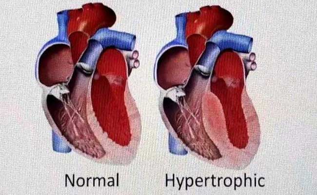अब पैदा होंगे डिजाइनर बच्चे? अमेरिका का पहला कदम, जानें पूरा मामला