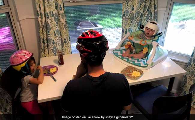 Family's Show Of Support After Baby Has To Wear Helmet Is Winning Hearts