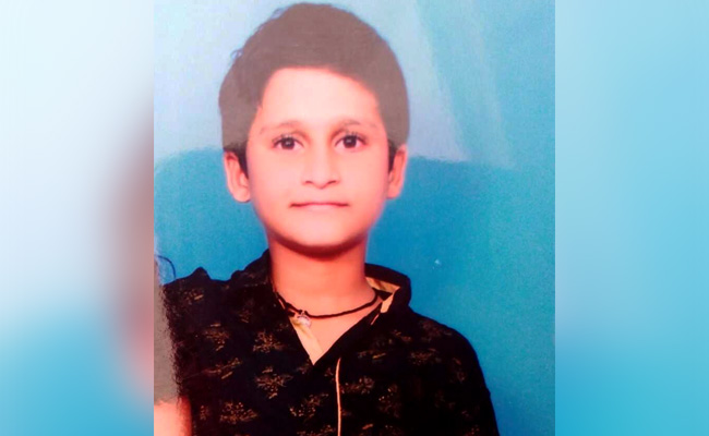 Schoolboy, 11, Imitates Daredevil Fire Breathing Act, Dies In Telangana