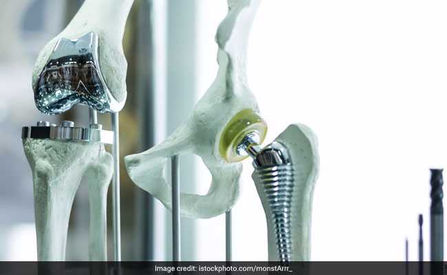 Move To Cap Knee Implant Prices Draws Flak From Health Tech Bodies