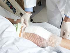 Knee Replacement: 100 किलो की इराकी महिला की सफल नी रिप्लेसमेन्ट सर्जरी...