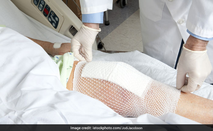 Knee Transplants To Cost Much Less, Prices Capped At Rs 55,000