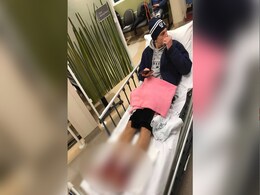 Flesh-Eating Sea Bugs Attacked An Australian Teen's Legs: 'There Was No Stopping The Bleeding.' Flesh-Eating Sea Bugs Attacked An Australian Teen's Legs: 'There Was No Stopping The Bleeding.'