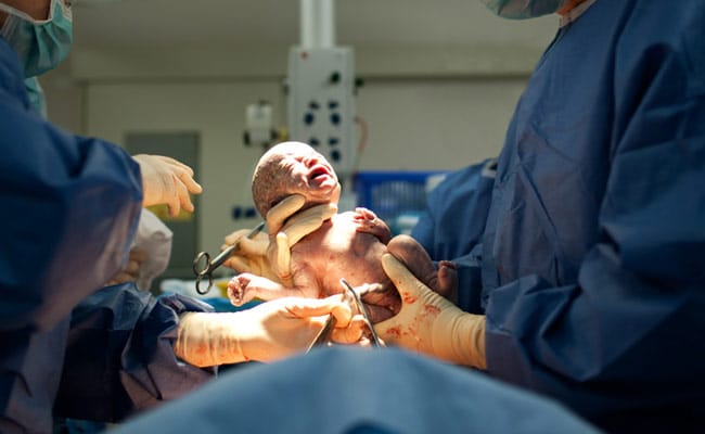 6 Reasons Why You May Need A C-Section Delivery