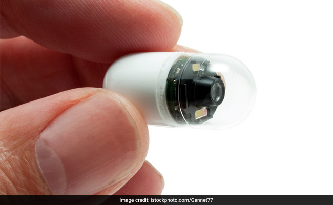 An Indian Scientist Leads UK Team To Create A Camera That Can See Through Human Body