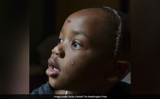 Road Rage, Bullet To Head - And Frantic Effort To Save A 4-Year-Old Road Rage, Bullet To Head - And Frantic Effort To Save A 4-Year-Old