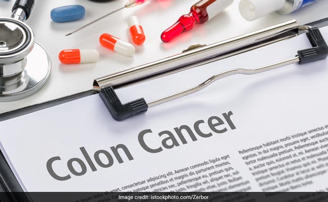 Colorectal Cancer: क्या है बड़ी आंत के कैंसर के कारण, कैसे टारगेटेड थेरेपी, इम्यूनोथेरेपी से सम्भव है इलाज