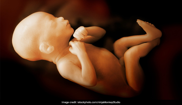 13-Year-Old Rape Survivor's Baby Dies 48 Hours After Birth