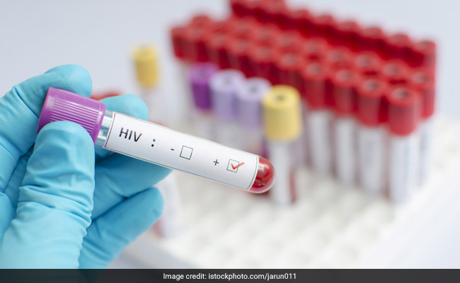 संक्रमित खून चढ़ाए जाने से 18 लोग HIV की चपेट में आए : रिपोर्ट  