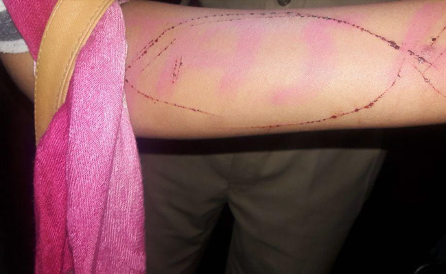 Goa Releases 'Blue Whale' Suicide Advisory For Schools