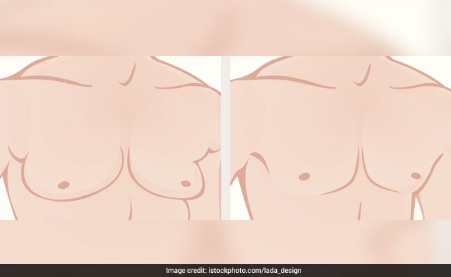 Top 3 Ways To Get Rid Of Male Breasts