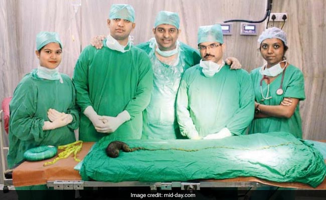 Mumbai Doctors Remove 750 Gms Of Hair From Woman Addicted To Eating It