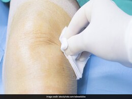 Over 400 People Peddle To Create Awareness About Stem Cell Donation Over 400 People Peddle To Create Awareness About Stem Cell Donation