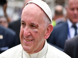 Pope Bumps Head, Hurts Left Eye While Riding Popemobile In Colombia Pope Bumps Head, Hurts Left Eye While Riding Popemobile In Colombia