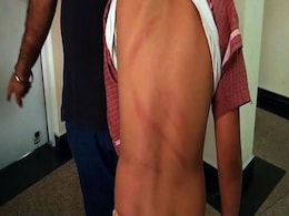 10-Year-Old Beaten Up Allegedly By Teachers At Ludhiana's Ryan International School 10-Year-Old Beaten Up Allegedly By Teachers At Ludhiana's Ryan International School