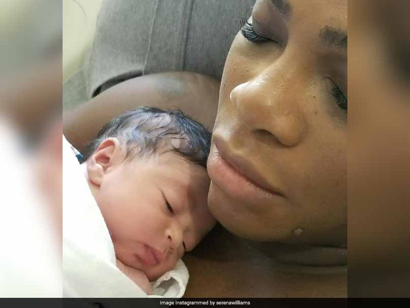Serena Williams Tells Scary Story of Childbirth Complications