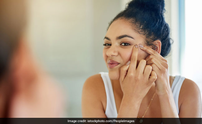 India Aces Acne, Scar Removal Treatment And Hacks To Avoid Acne