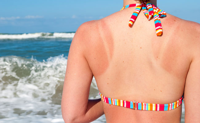 Negative Impact Of Sun On The Body & How To Protect Ourselves From It