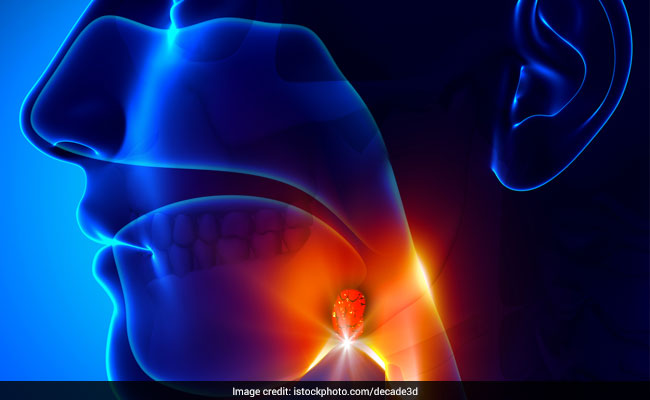 Take Note Of These Home Remedies For Tonsils