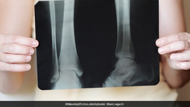 Dairy Plus These 5 Foods Are Your Key To Stronger Bones