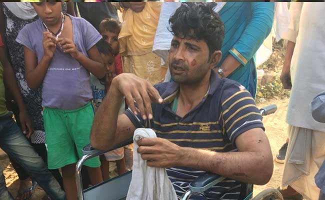 फ़रीदाबाद में गौरक्षकों की गुंडागर्दी! गौमांस ले जाने के शक में विकलांग शख्स को बुरी तरह पीटा