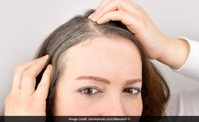 Frequent Hair Dying Linked To Breast Cancer: Tips To Cover Greys Naturally