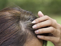 7 Amazing Home Remedies To Cover Your Grey Hair Naturally