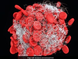 Can A Blood Clot Kill You? Can A Blood Clot Kill You?