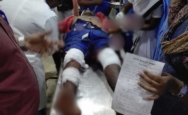 RSS Worker Injured In Attack By Suspected Left Activists In Kerala: Cops
