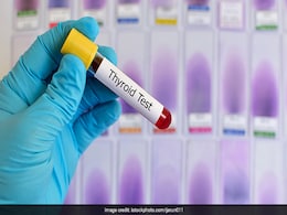 थायराइड का रामबाण इलाज है इस बीज का पानी, रोज बनाकर पीना होगा इस तरह, फिर thyroid एकदम हो जाएगा ठीक थायराइड का रामबाण इलाज है इस बीज का पानी, रोज बनाकर पीना होगा इस तरह, फिर thyroid एकदम हो जाएगा ठीक