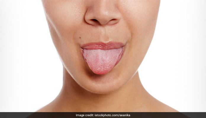 Did You Know: Your Tongue Is Always Young!